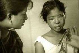 In Bangladesh le donne sono spesso vittime di aggressioni, soprattutto con acidi