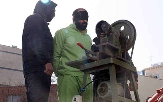 IRAN - Amputazione